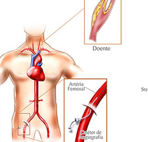 Dr. Fábio Gallette - Cirurgia Vascular