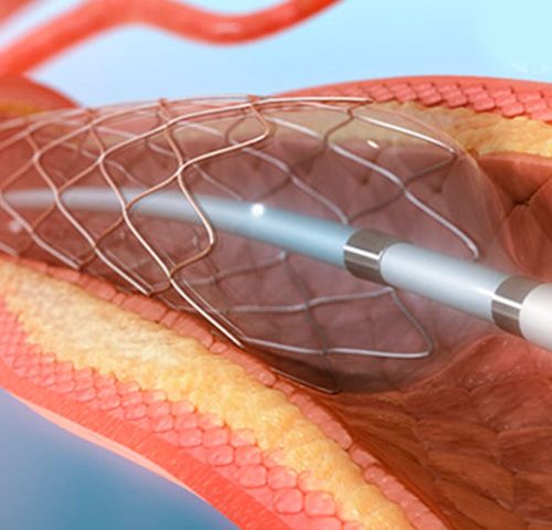 Dr. Fábio Gallette - Cirurgia Vascular